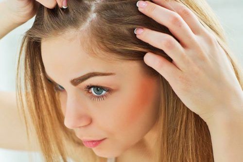 Best Anti Dandruff Shampoo Products For Your Beautiful Hair